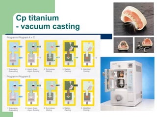 Cp titanium
- vacuum casting

www.indiandentalacademy.com

 