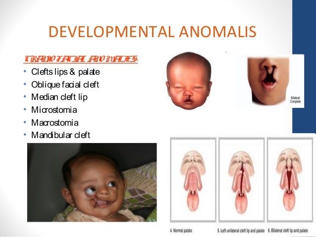 Development of face