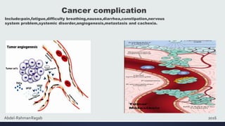 A Review on Protein and Cancer ; Etiology, Metabolism and Management | PPTX