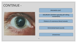 CONTINUE -
DRUNKEN GAIT
DELIRIUM (Exhibits typically pill rolling
movement)
Dilation of cutaneous blood vessels
Diminished bowl sounds
drowsiness
 