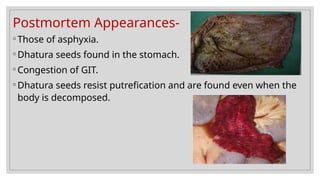 Postmortem Appearances-
◦ Those of asphyxia.
◦ Dhatura seeds found in the stomach.
◦ Congestion of GIT.
◦ Dhatura seeds resist putrefication and are found even when the
body is decomposed.
 