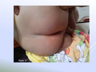 Ngày 27
 