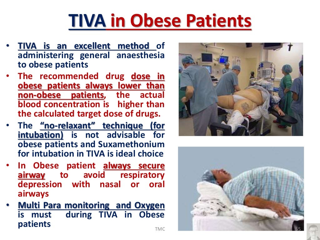 Total Intravenous Anesthesia(TIVA), recent updates
