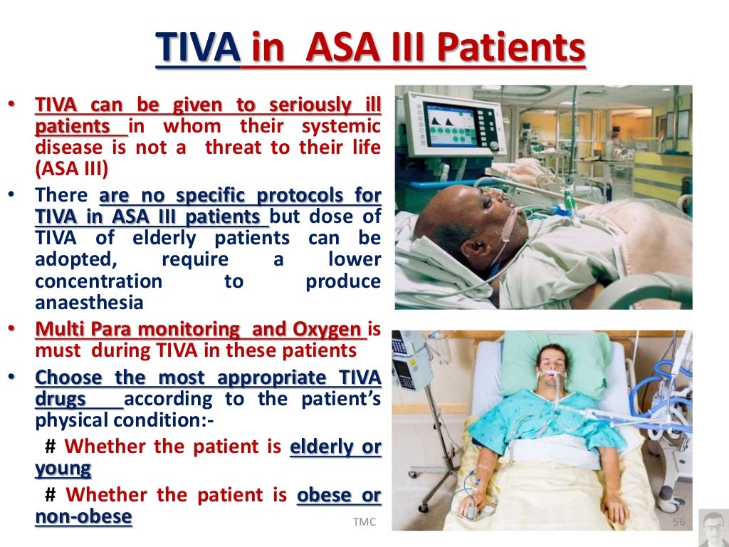 Total Intravenous Anesthesia(TIVA), recent updates