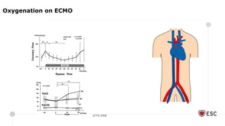 JCTS 2009
Oxygenation on ECMO
 