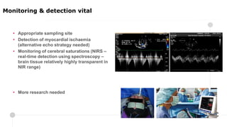 • Appropriate sampling site
• Detection of myocardial ischaemia
(alternative echo strategy needed)
• Monitoring of cerebral saturations (NIRS –
real-time detection using spectroscopy –
brain tissue relatively highly transparent in
NIR range)
• More research needed
Monitoring & detection vital
 