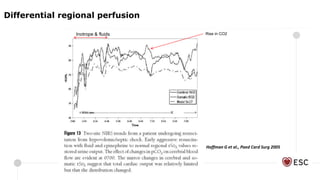 Hoffman G et al., Paed Card Surg 2005
Inotrope & fluids Rise in CO2
Differential regional perfusion
 