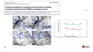 CS: a multisystem disease
 