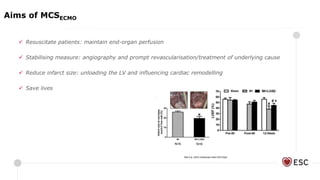  Resuscitate patients: maintain end-organ perfusion
 Stabilising measure: angiography and prompt revascularisation/treatment of underlying cause
 Reduce infarct size: unloading the LV and influencing cardiac remodelling
 Save lives
Aims of MCSECMO
 