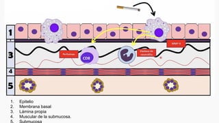1. Epitelio
2. Membrana basal
3. Lámina propia
4. Muscular de la submucosa.
 