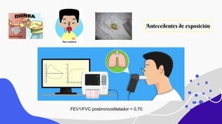 Antecedentes de exposición
FEV1/FVC posbroncodilatador < 0,70.
 