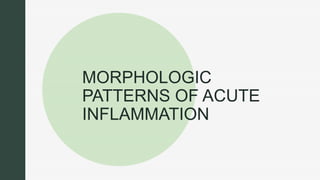 z
z
MORPHOLOGIC
PATTERNS OF ACUTE
INFLAMMATION
 
