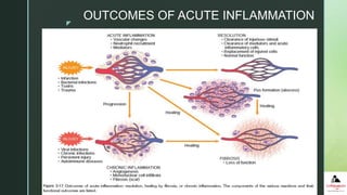 z
OUTCOMES OF ACUTE INFLAMMATION
 