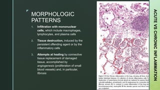 zz
MORPHOLOGIC
PATTERNS
1. Infiltration with mononuclear
cells, which include macrophages,
lymphocytes, and plasma cells
2. Tissue destruction, induced by the
persistent offending agent or by the
inflammatory cells
3. Attempts at healing by connective
tissue replacement of damaged
tissue, accomplished by
angiogenesis (proliferation of small
blood vessels) and, in particular,
fibrosis
ACUTEVSCHRONICINFLAMMATION
 
