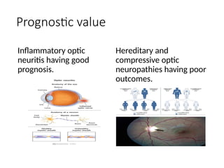 Prognostic value
Inflammatory optic
neuritis having good
prognosis.
Hereditary and
compressive optic
neuropathies having poor
outcomes.
 