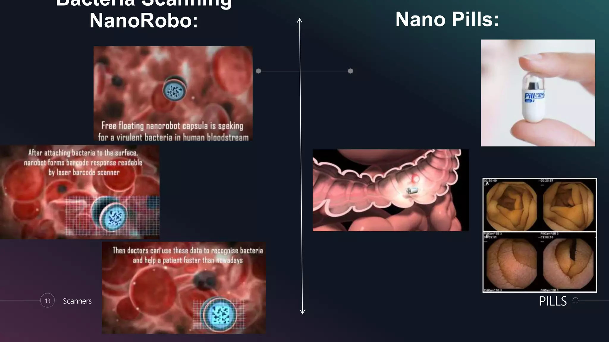 Nano Pills:
13 Scanners PILLS
Bacteria Scanning
NanoRobo:
 