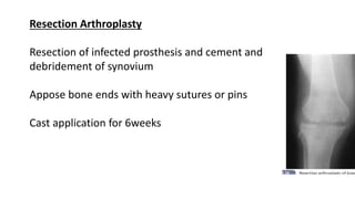 Resection Arthroplasty
Resection of infected prosthesis and cement and
debridement of synovium
Appose bone ends with heavy sutures or pins
Cast application for 6weeks
 