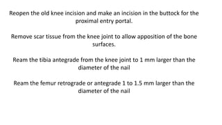 Reopen the old knee incision and make an incision in the buttock for the
proximal entry portal.
Remove scar tissue from the knee joint to allow apposition of the bone
surfaces.
Ream the tibia antegrade from the knee joint to 1 mm larger than the
diameter of the nail
Ream the femur retrograde or antegrade 1 to 1.5 mm larger than the
diameter of the nail
 
