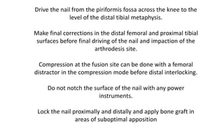 Drive the nail from the piriformis fossa across the knee to the
level of the distal tibial metaphysis.
Make final corrections in the distal femoral and proximal tibial
surfaces before final driving of the nail and impaction of the
arthrodesis site.
Compression at the fusion site can be done with a femoral
distractor in the compression mode before distal interlocking.
Do not notch the surface of the nail with any power
instruments.
Lock the nail proximally and distally and apply bone graft in
areas of suboptimal apposition
 