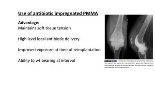Use of antibiotic impregnated PMMA
Advantage:
Maintains soft tissue tension
High level local antibiotic delivery
Improved exposure at time of reimplantation
Ability to wt bearing at interval
 