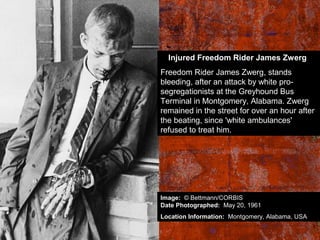 Injured Freedom Rider James Zwerg
Freedom Rider James Zwerg, stands
bleeding, after an attack by white pro-
segregationists at the Greyhound Bus
Terminal in Montgomery, Alabama. Zwerg
remained in the street for over an hour after
the beating, since 'white ambulances'
refused to treat him.
Image: © Bettmann/CORBIS
Date Photographed: May 20, 1961
Location Information: Montgomery, Alabama, USA
 