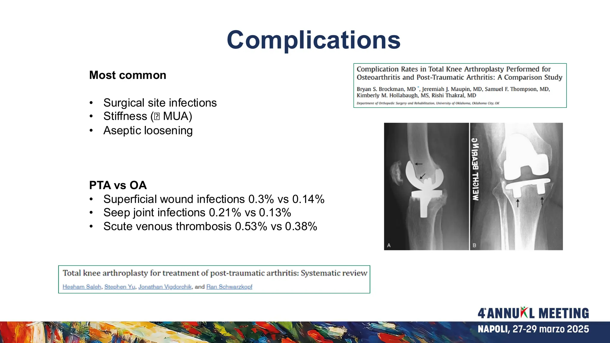 TKA in stiff knee - how to manage the right patient | PDF