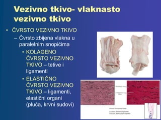 Vezivno tkivo- vlaknasto
vezivno tkivo
• ČVRSTO VEZIVNO TKIVO
– Čvrsto zbijena vlakna u
paralelnim snopićima
• KOLAGENO
ČVRSTO VEZIVNO
TKIVO – tetive i
ligamenti
• ELASTIČNO
ČVRSTO VEZIVNO
TKIVO – ligamenti,
elastični organi
(pluća, krvni sudovi)
 