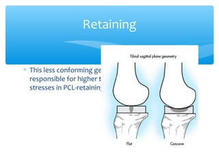 ∗ This less conforming geometry in the sagittal plane is
responsible for higher tibial polyethylene contact
stresses in PCL-retaining prostheses
Retaining
 