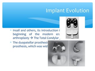 ∗ Insall and others, its introduction in 1973 marked the
beginning of the modern era of total knee
arthroplasty  The Total Condylar prostesis
∗ The duopatellar prosthesis evolved into the kinematic
prosthesis, which was widely used in the 1980s
Implant Evolution
 