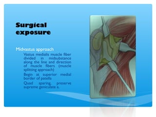 Surgical
exposure
Midvastus approach
Vastus medialis muscle fiber
divided in midsubstance
along the line and direction
of muscle fibers (muscle
splitting approach)
Begin at superior medial
border of patella
Quad sparing, preserve
supreme geniculate a.
 