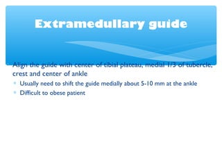 Extramedullary guide
∗ Align the guide with center of tibial plateau, medial 1/3 of tubercle,
crest and center of ankle
∗ Usually need to shift the guide medially about 5-10 mm at the ankle
∗ Difficult to obese patient
 