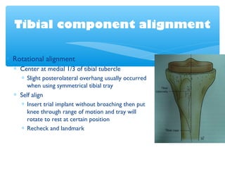 Tibial component alignment
∗ Rotational alignment
∗ Center at medial 1/3 of tibial tubercle
∗ Slight posterolateral overhang usually occurred
when using symmetrical tibial tray
∗ Self align
∗ Insert trial implant without broaching then put
knee through range of motion and tray will
rotate to rest at certain position
∗ Recheck and landmark
 