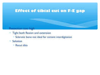 Effect of tibial cut on F-E gap
∗ Resection too high
∗ Tight both flexion and extension
∗ Sclerotic bone not ideal for cement interdigitation
∗ Solution
∗ Recut tibia
 