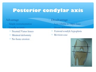 Posterior condylar axis
∗ Advantage
∗ Simple instrumentation
∗ Usually accurate
∗ Neutral/Varus knees
∗ Minimal deformity
∗ No bone erosion
∗ Disadvantage
∗ Less reliable in valgus knee
∗ Severe deformity
∗ Femoral condyle hypoplasia
∗ Revision case
 