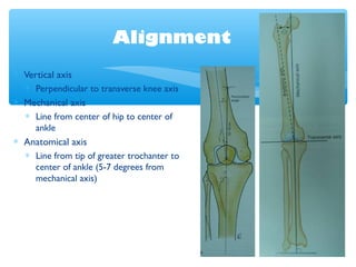 Alignment
∗ Vertical axis
∗ Perpendicular to transverse knee axis
∗ Mechanical axis
∗ Line from center of hip to center of...