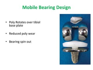 Mobile Bearing Design
• Poly Rotates over tibial
base plate
• Reduced poly wear
• Bearing spin out
 