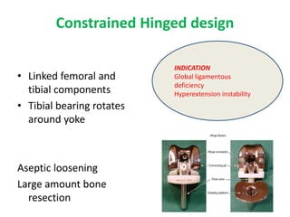 Constrained Hinged design
• Linked femoral and
tibial components
• Tibial bearing rotates
around yoke
Aseptic loosening
Large amount bone
resection
INDICATION
Global ligamentous
deficiency
Hyperextension instability
 