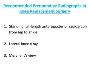 Recommended Preoperative Radiographs in
Knee Replacement Surgery
1. Standing full-length anteroposterior radiograph
from hip to ankle
2. Lateral knee x ray
3. Merchant’s view
 