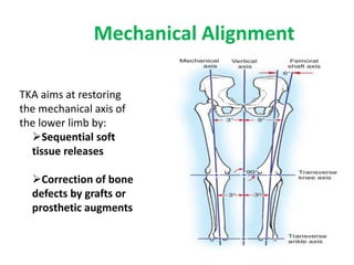 Mechanical Alignment
TKA aims at restoring
the mechanical axis of
the lower limb by:
Sequential soft
tissue releases
Correction of bone
defects by grafts or
prosthetic augments
 