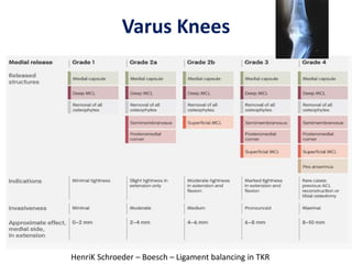 Varus Knees
HenriK Schroeder – Boesch – Ligament balancing in TKR
 