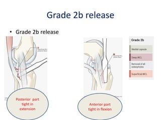 Grade 2b release
• Grade 2b release
Posterior part
tight in
extension
Anterior part
tight in flexion
 