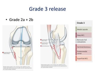 Grade 3 release
• Grade 2a + 2b
 