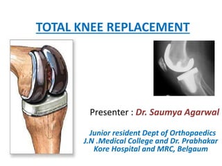 TOTAL KNEE REPLACEMENT
Presenter : Dr. Saumya Agarwal
Junior resident Dept of Orthopaedics
J.N .Medical College and Dr. Prabhakar
Kore Hospital and MRC, Belgaum
 