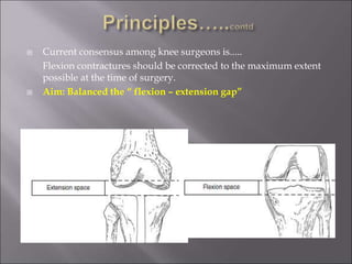 Total Knee Replacement (TKR) in advanced arthritis | PPT