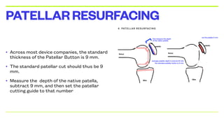 • Across most device companies, the standard
thickness of the Patellar Button is 9 mm.
• The standard patellar cut should thus be 9
mm.
• Measure the depth of the native patella,
subtract 9 mm, and then set the patellar
cutting guide to that number
PATELLARRESURFACING
 
