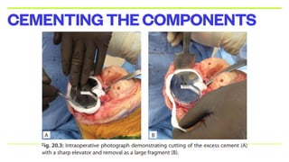 CEMENTINGTHECOMPONENTS
 
