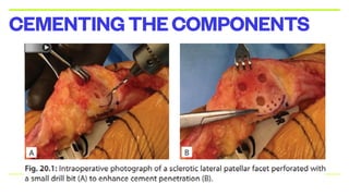 CEMENTINGTHECOMPONENTS
 