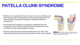• Patellar clunk syndrome occurs when scar tissue builds up at
the superior pole of the patella and becomes trapped in the
intercondylar housing of a posterior stabilized femoral
component
• minimized if the design of a posterior stabilized femoral
component has a smooth and lowered transition from the
trochlea into the intercondylar housing.
• Also by surgical removal of all residual synovium from the
quadriceps tendon just above the superior pole of the patella
.
PATELLACLUNKSYNDROME
 
