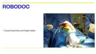 • Customized foot and thigh holder.
ROBODOC
 
