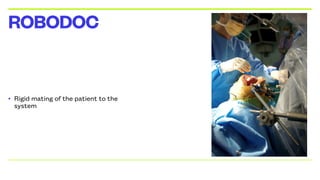• Rigid mating of the patient to the
system
ROBODOC
 